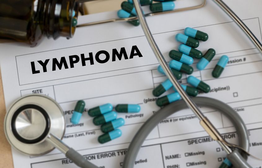 Lymphoma diagnózis