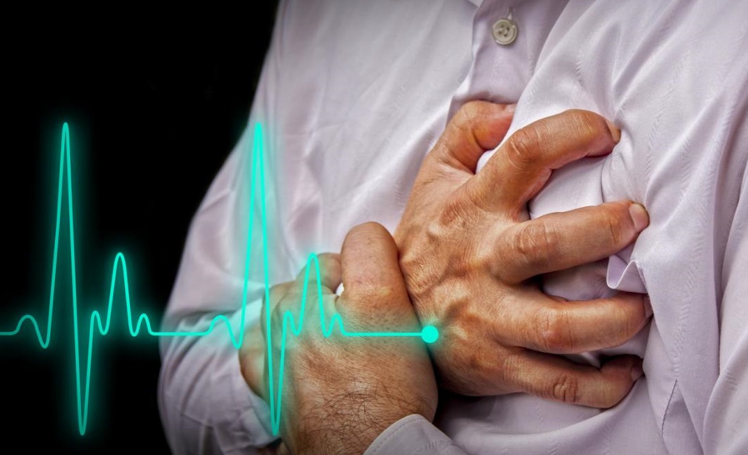 Új módszert dolgozott ki a SOTE kutatója az infarktuskockázat megállapítására