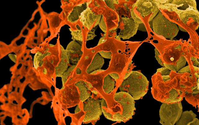 mrsa