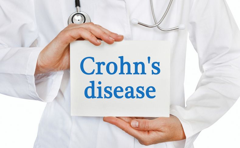 Crohn-betegség