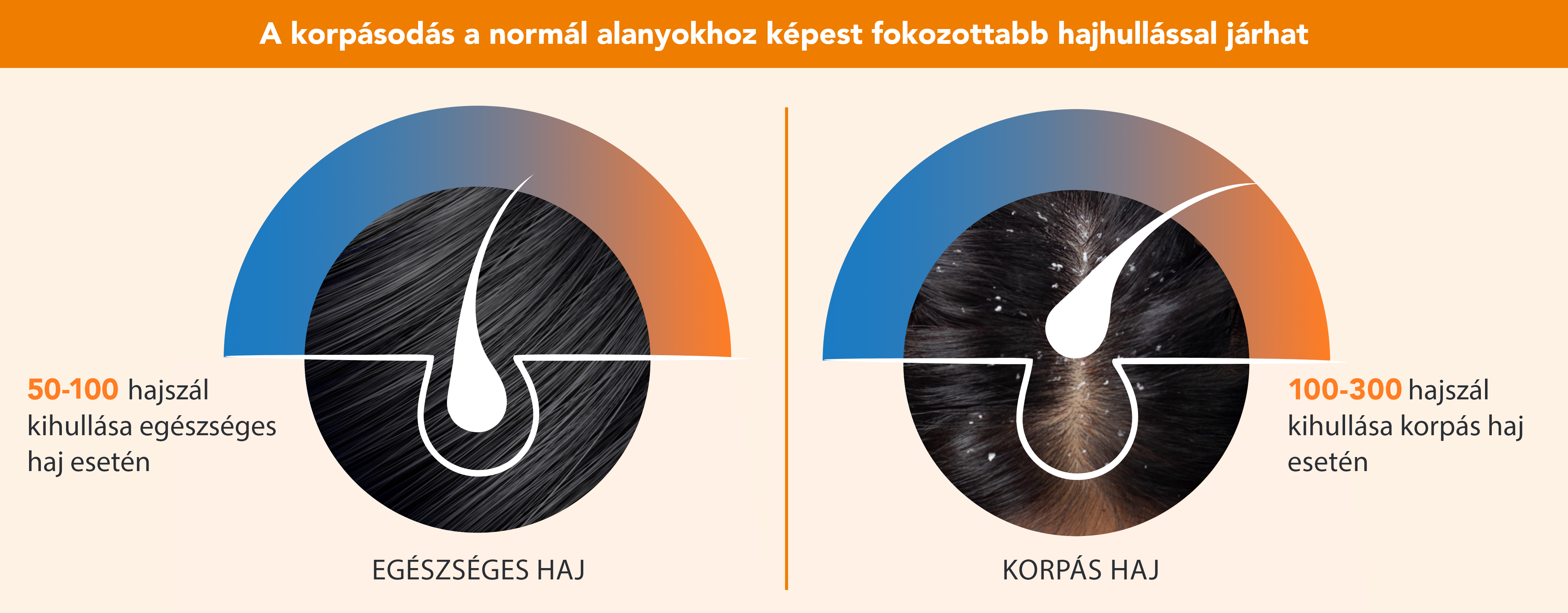 Egészséges és korpás haj összehasonlítása
