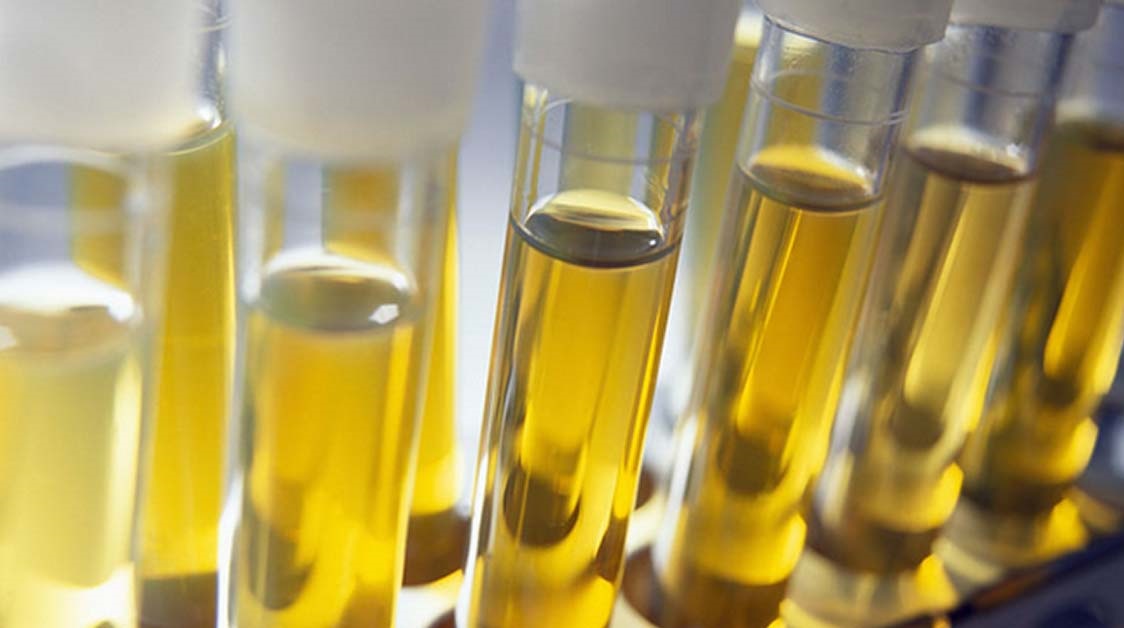 Urine